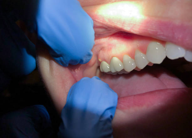 Best Pediatric Emergency Dentist in Montoursville, PA
