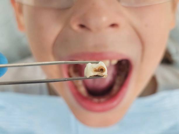 Best After-Hours Emergency Dentist in Montoursville, PA